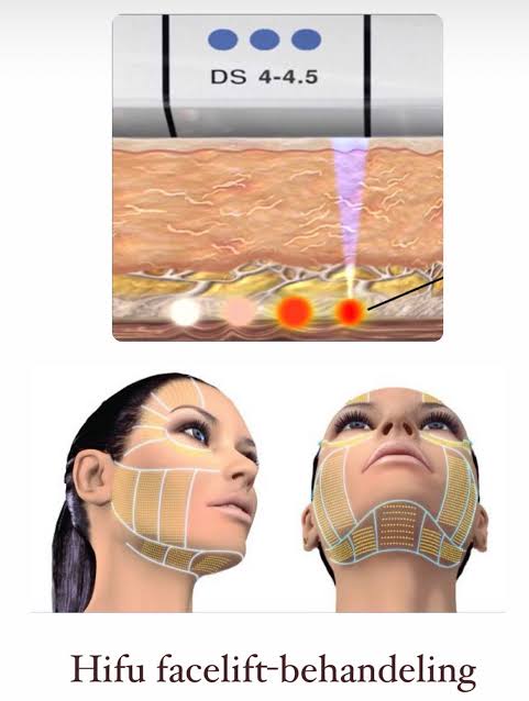 الوجه بالكامل (شد)